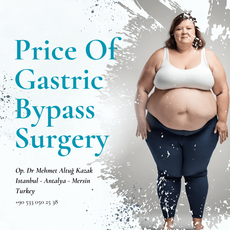 Price Of Gastric Bypass Surgery