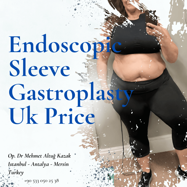 Endoscopic Sleeve Gastroplasty Uk Price